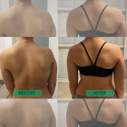 Posture Corrector