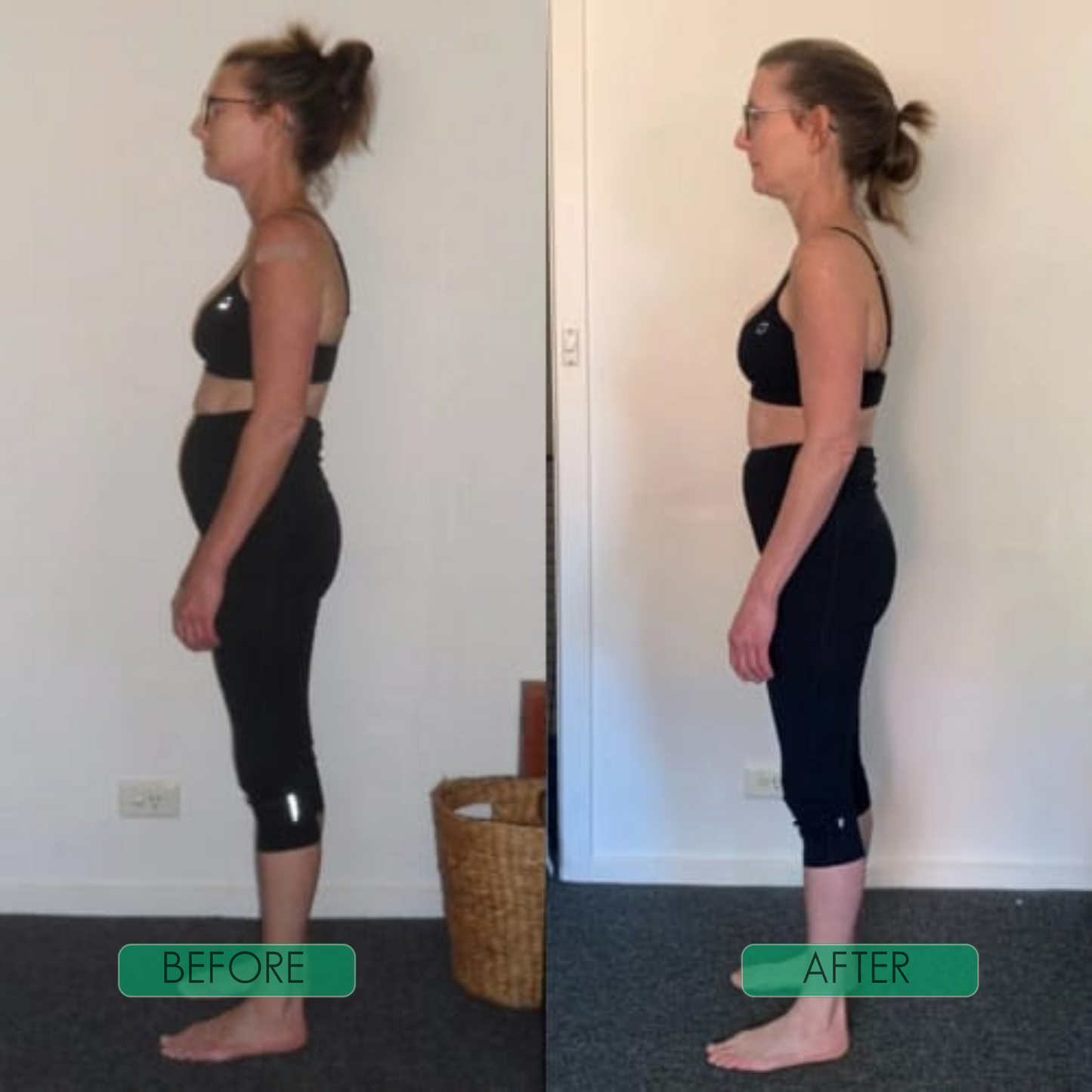 Posture Corrector